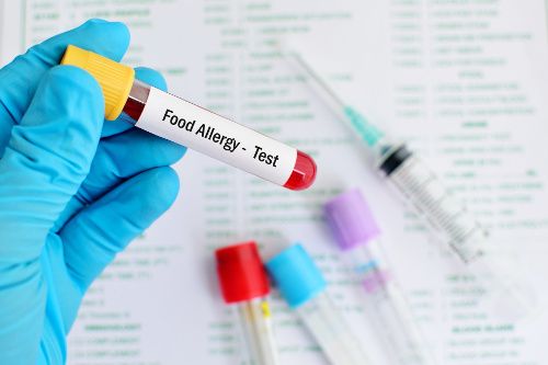 A food allergens image showing a blood sample tube labelled "Food Allergy - Test."